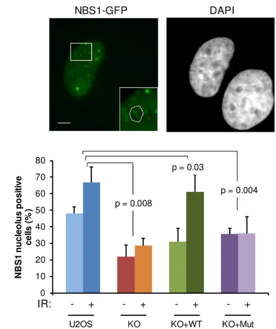 Fig 10. NBS1 localization in nucleoli after DNA damage is dependent on JMJD6. (A) Representative images of U2OS cells expressing NBS1-GFP after IR exposure (5 Gy)