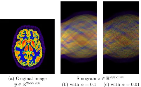 Figure 2: Example of degradation encountered in positron emission tomography. y models the activity in the Zubal brain phantom [196]