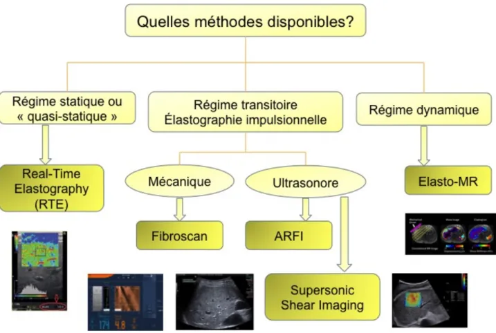 Figure  2  :  organigramme  résumant  les  différentes  techniques  d’élastographie  disponibles  en  2013    