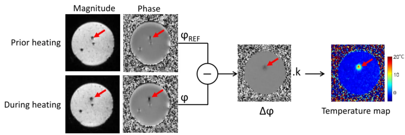 Figure 2.1: Basic principle of PRF thermometry method on a static agar gel phantom. Magnitude and phase images are acquired using a fast EPI pulse sequence