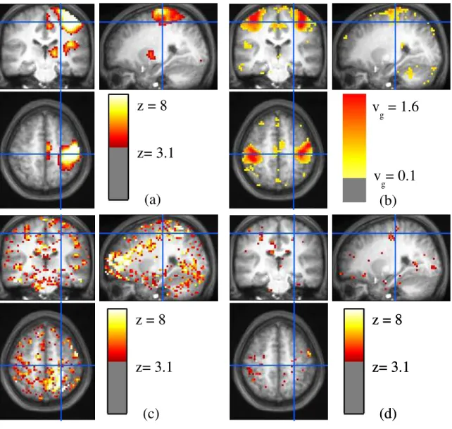 Figure 3.6: Statistical model of the effects for the left-right button press contrast, on S = 81 subjects