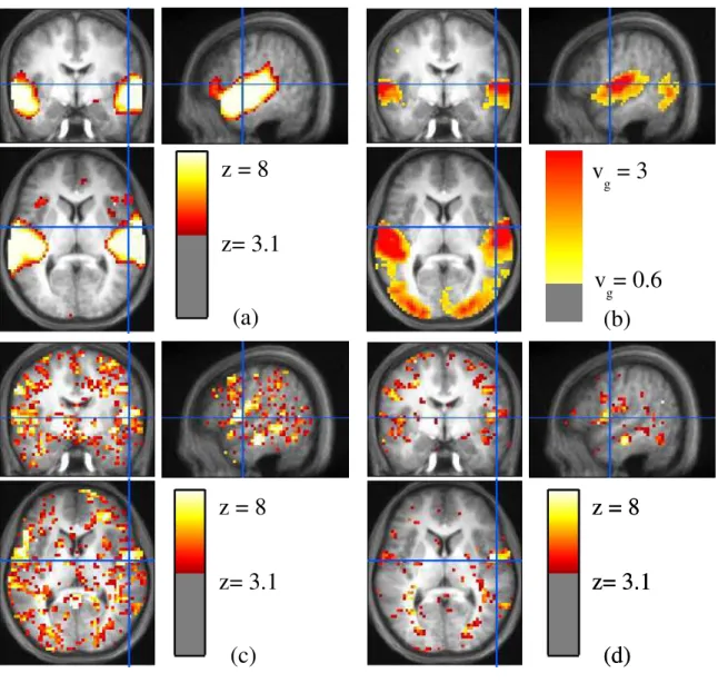 Figure 3.7: Statistical model of the effects for the audio instructions-video instructions contrast, on S = 81 subjects