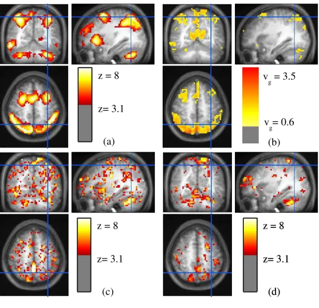 Figure 3.8: Statistical model of the effects for the computation-reading contrast, on S = 81 subjects