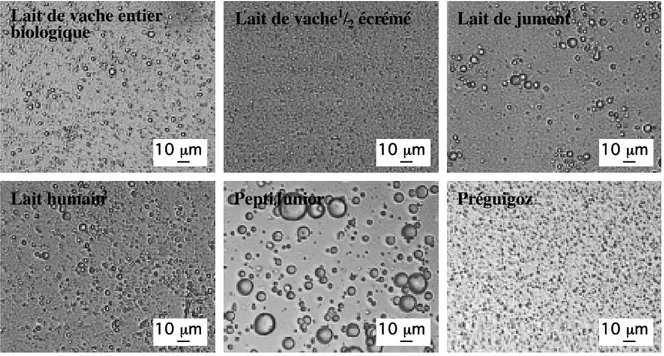 Figure  7:  Photographies  réalisées  à partir de l’observation microscopique  de globules  lipidiques dans différents laits et préparations pour nourrissons (Favé et al., Cell Mol Biol, 2004, 50, 815-831).