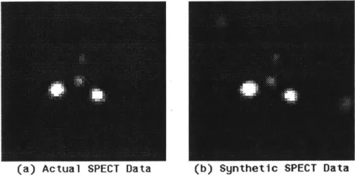 Figure  2:  Comparison  of  clinically  obtained  phantom  data  (a)  and  synthetic SPECT  data  (b).