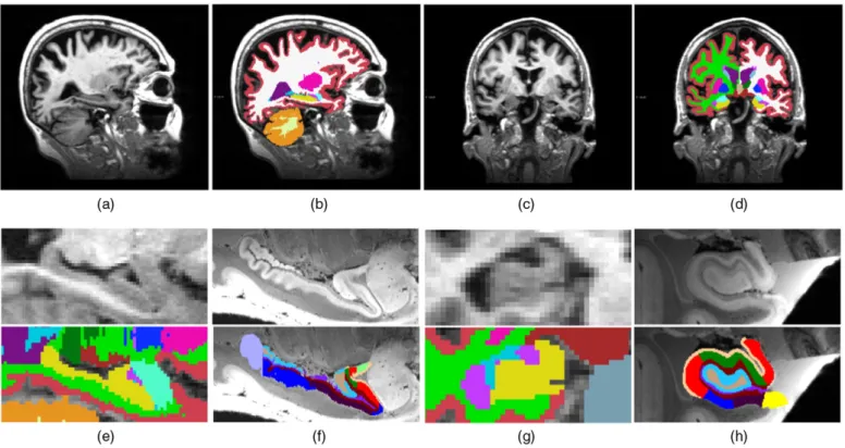 Fig. 3. In vivo dataset and comparison with ex vivo images. (a) Sagittal slice in vivo
