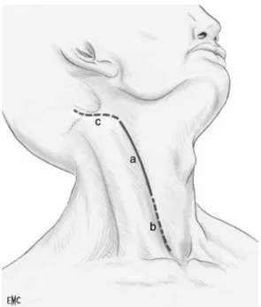 Figure 11 : incision cutanée pré sterno-cléido-mastoïdienne 