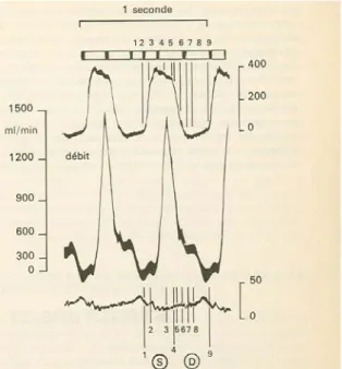 Figure 15 : Débit cave à différent moment du cycle cardiaque (thorax ouvert). De haut en bas,  Pression ventriculaire droite en mmH 2 O, débit cave en ml/min pression veineuse centrale en mmH 2 O