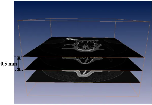 Figure 2-1 : Pile d’images issues de l’examen tomodensitométrique de la tête plastinée espacées de 0,5 mm