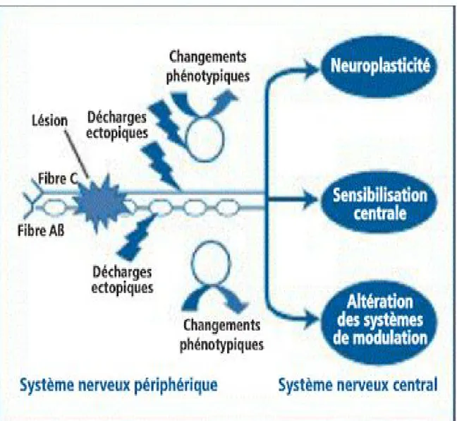Figure 1 : Illustration schématique des principaux mécanismes périphériques et  centraux à l’origine des douleurs neuropathiques périphériques et cibles d’action 