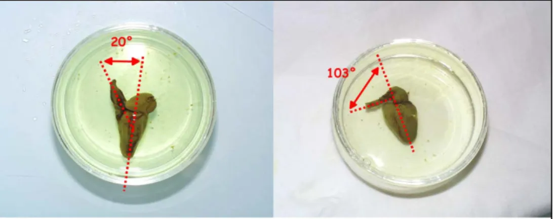 Figure 2 : Différences de morphologie du cœur chez la truite commune (Salmo trutta)  d’élevage à la SEMII
