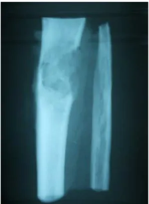figure 9: radiographie de la piece d’exerese 