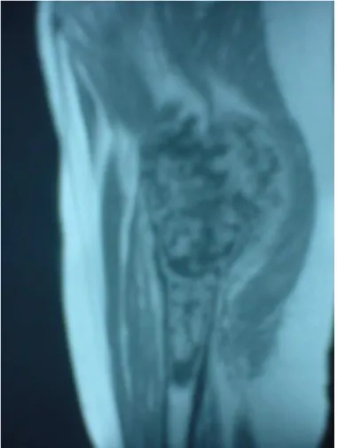 Figure 16: IRM de la patiente 