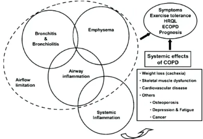 figure  2).  Cela  signifie  que  la  BPCO  se  caractérise  par  des  différences interindividuelles que  ce  soit  au  niveau  de  l’atteinte  pulmonaire  ou  des  autres  conséquences systémiques de la  maladie