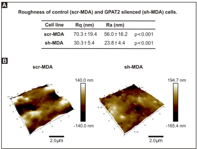 Fig 5. Cells sub-expressing GPAT2 exhibit smoother topography. A) Ra and Rq values of scr-MDA and sh-MDA cells