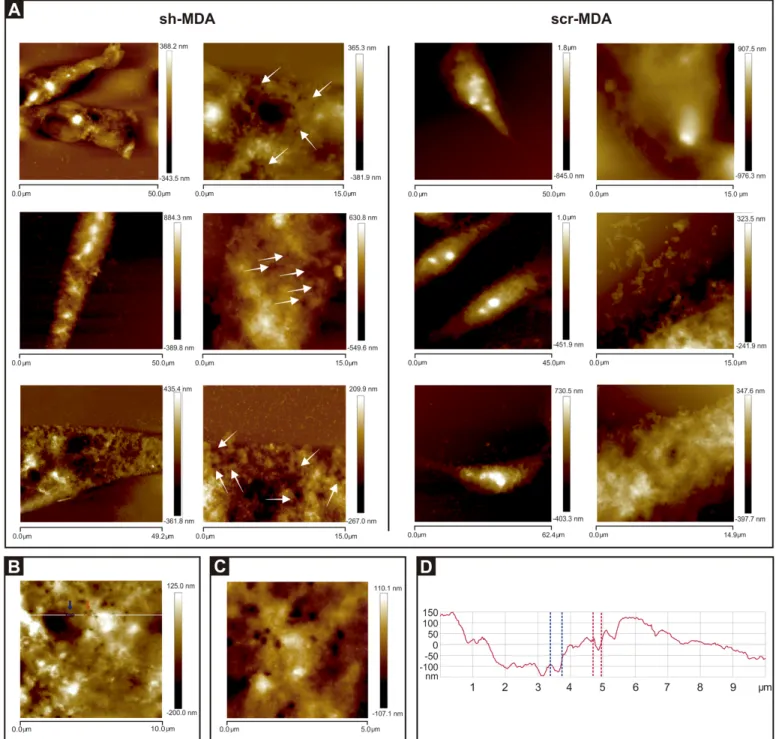 Fig 6. Cells sub-expressing GPAT2 exhibit pore-like structures. A) Representative AFM images of three different sh-MDA and scr-MDA cells revealed pore-like structures only on the surface of sh-MDA cells indicated with white arrows in 15.0 μm x 15.0 μm imag