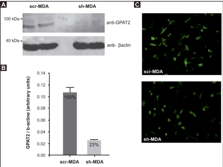 Fig 1. GPAT2 knock-down in MDA-MB-231 cells. MDA-MB-231 cells were silenced for human GPAT2 with HuSH-29 plasmid coding for a shRNA against human GPAT2 mRNA (sh-MDA)