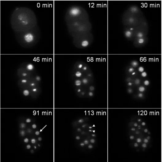 Figure 6: Recording of a C. elegans embryo expressing an histone::GFP fusion. Single plane images of a transgenic embryo expressing an histone::GFP fusion (zuIs178; stIs10024) at different time points