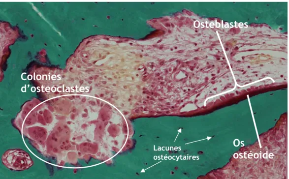Figure 5 : Vue des différents types de cellules osseuses et leur localisation respective sur la surface  osseuse sur une coupe d’histomorphométrie, coloré par le trichrome de Goldner