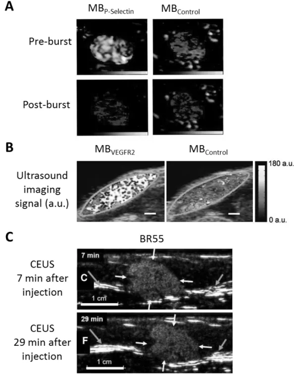 Figure II.1.3: Evolution of USMI over time. (A) One of the first in vivo studies of USMI with P-selectin-targeted  MBs in mouse kidneys after ischemia-reperfusion injury (128)