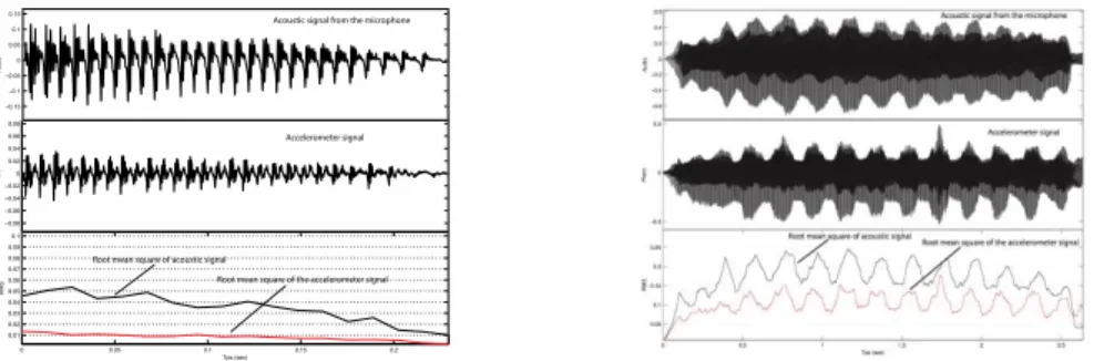Fig. 8.  The  two  figures  show  the  acoustic  (top)  and  accelerometer  (mid)  signals  for  the  same  vowel  /a/  in  spoken  (left)  and  singing  (right)  task
