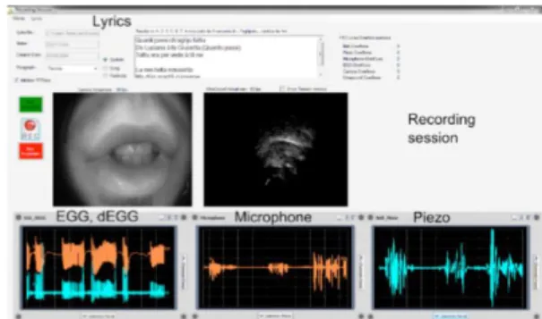 Fig.  2:  Screen  snapshot  of  the  recording  session  software  [10].  Top:  display  of  Cantu  in  Paghjella  lyrics