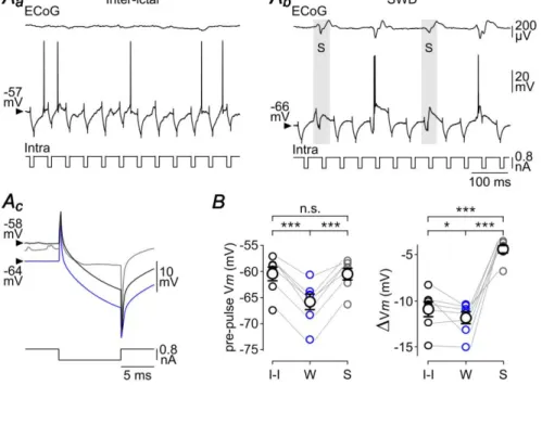 Figure  7.  The  S-component  of  the  seizure  results  in  a  powerful  shunting  inhibition  of  cortical  neurons