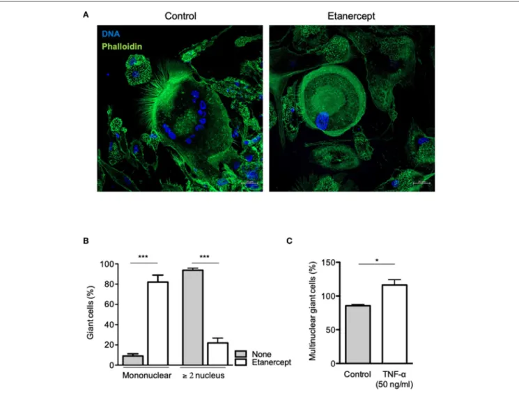 FIGURE 4 | Etanercept inhibits cell fusion. Adherent CD14 + cells from healthy donors (n = 5) were stimulated with IFN-γ and ConA in the presence or not of etanercept and cell-cell fusion was measured by the appearance multinucleated giant cells (≥2 nucleu