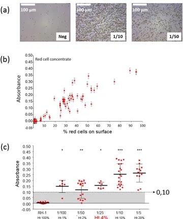 Figure a. Experimental results concerning Rhesus compatibility. (a) Pictures of negative and positive biochips  (red  cell  concentrate  diluted  at  1/10  and  1/50)