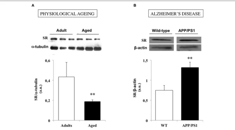 FIGURE 3 | Serine racemase (SR) expression is down and up regulated in physiological and pathological brain aging respectively