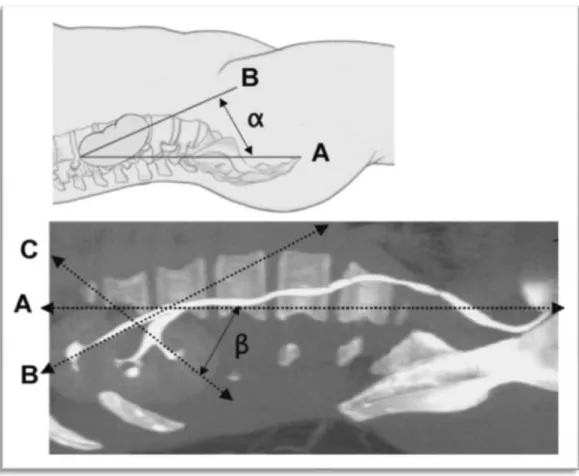 Fig.  36:  Vue  sagittale  de  la  VESI  sur  un  cliché  reconstruit  d’uro-TDM  et  sur  un  schéma