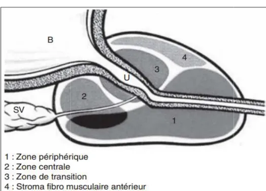 Figure 4 : anatomie zonale de la prostate selon Mc Neal: 