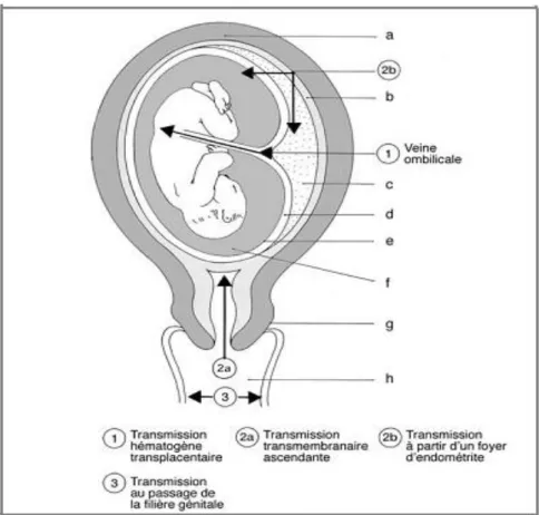 Figure  1 :  Mode  de  contamination  maternofoetal :  a.  Muscle  utérin;  b. 