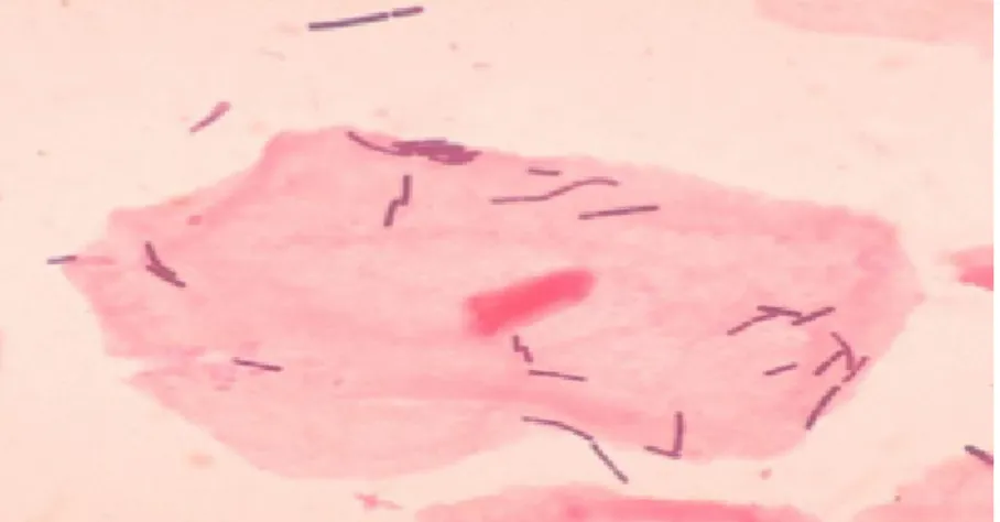 Figure 3 : Flore vaginale normale : flore de Doderlein [23]. 