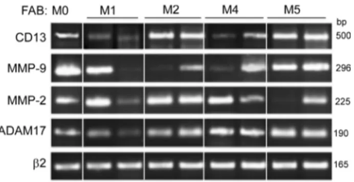 Figure 1: PCR analyses of CD13, MMP-9, MMP-2 and  ADAM17 transcripts in primary AML cells