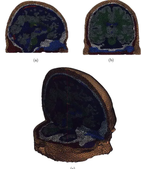 Figure  3-2:  Full  head  model:  sagittal  cut  3-2(a),  coronal  cut  3-2(b),  and  combined sagittal  and  axial  cut  showing  detail  of the  full  mesh  3-2(c)