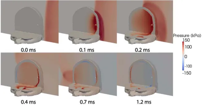 Figure 3-5: Snapshots showing the time evolution of pressure contours from the unprotected head simulation