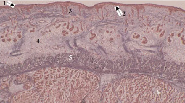 Fig. 1. Les 4 régions de la peau :  1 =épiderme  2 = jonction dermo-épidermique  3 = derme  4 = hypoderme  5 = aponévrose  6 =tissu musculaire