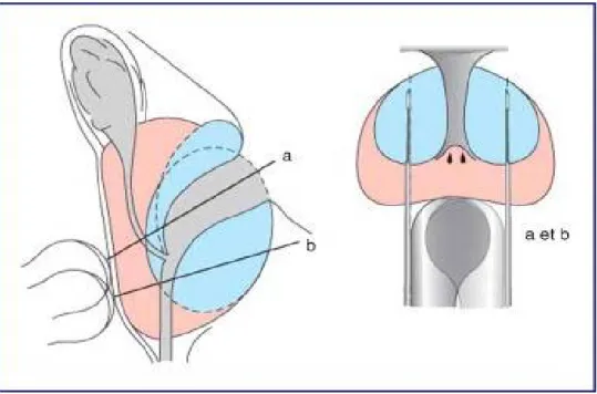 Figure 11: Schéma de 12 biopsies échoguidées en coupes sagittales (a) et oblique  latéralement (b)