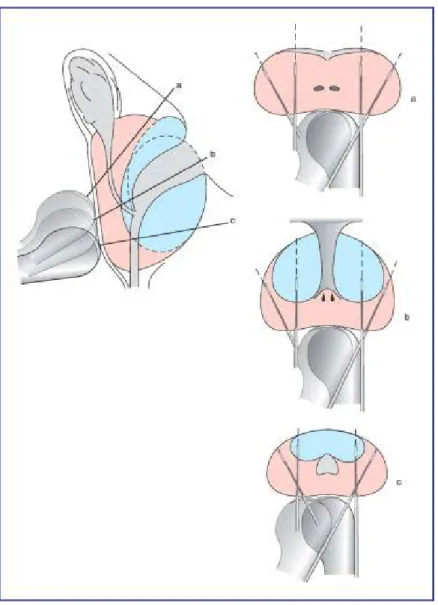 Figure 12: Schéma de 12 biopsies échoguidées en coupes frontales obliques ou transverses  avec des prélèvements réalisés au tiers supérieur, à la base (a), au tiers moyen, au milieu (b), 