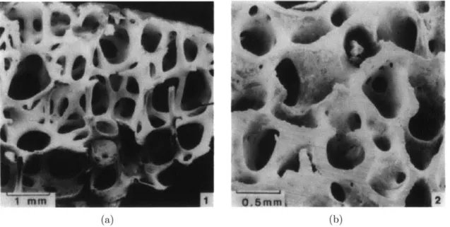 Figure  2-2:  Scanning  electron  micrograph  of low  density  (a)  rod-like  trabecular  bone and  high  density  (b)  plate-like  trabecular  bone  taken  from  the  femoral  head  of  a human  specimen  [9].