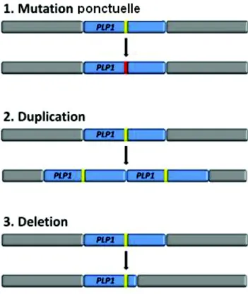 Figure 7 : Illustration schématique des 3 mécanismes de mutations impliqués dans la PMD