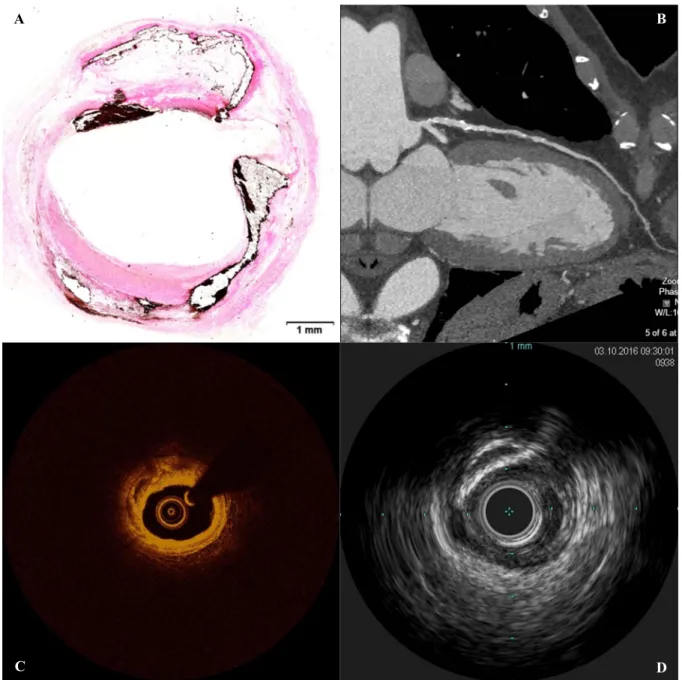 Figure 1.1. Various imaging modalities are associated with distinct benefits and limitations