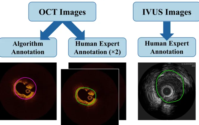 Figure 2.9. The method employing 2D shape fitting and integrating contextual information to delineate the vessel  wall in OCT was validated through comparison with human expert annotations in both OCT and IVUS images