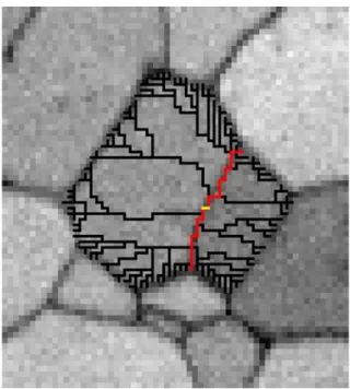 Fig. 4. Starting from the open frontier in yellow, all paths of minimum weight joining a closed boundary are browsed (in black)