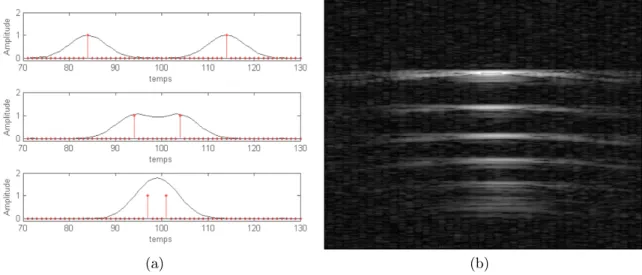 Figure 1.9  Problématique de la résolution dans les images ultrasonores. 1.9a présente les trois as de la résolution