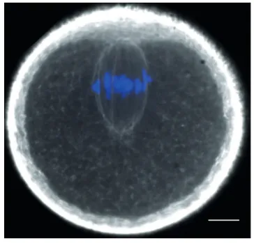 Figure 18: F-actin meshwork in late Metaphase I  in the mouse oocyte