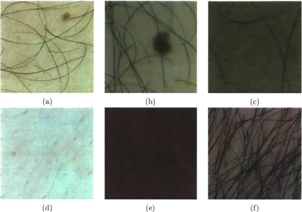 Figure  2-3:  a)  Thick,  dark,  individual  hair  strands  with  few  intersections  are  easy to  detect  with  existing  DHR  algorithms