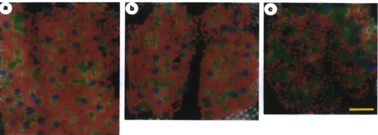 Figure  2-3:  Pseudocolor  images  from  various  retinal  regions  of  different  subjects,  courtesy  of Roorda  Lab  [163]