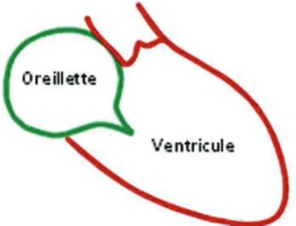 Figure 15 : Contraction iso-volumique 